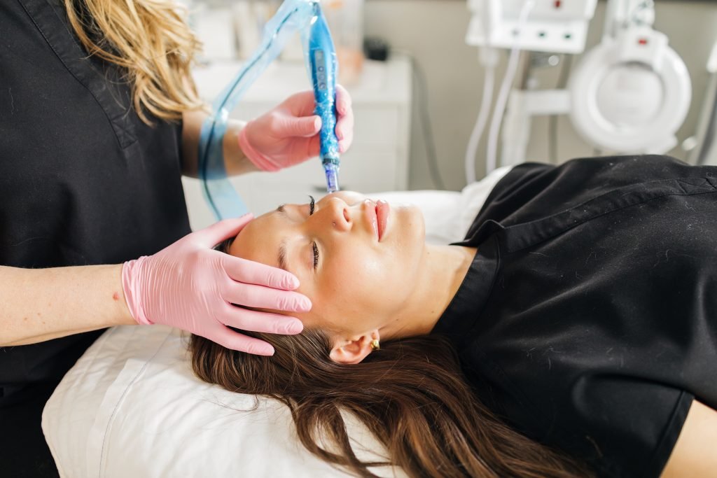 microneedling burnsville