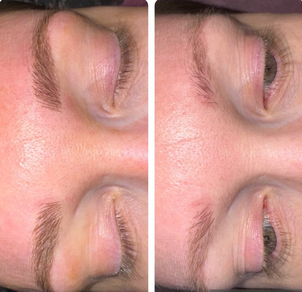 Microblading Burnsville