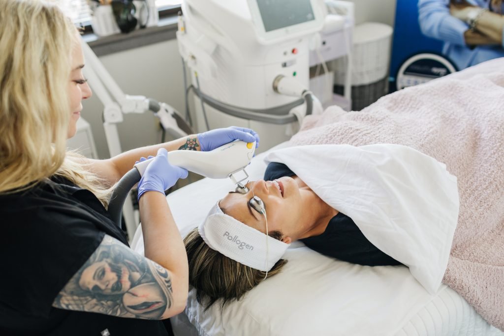 IPL Facial burnsville