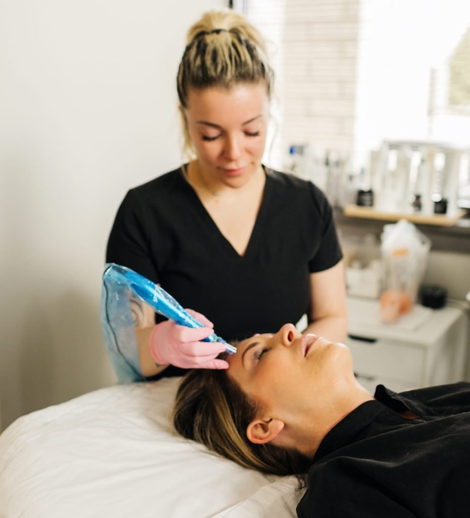 microneedling burnsville