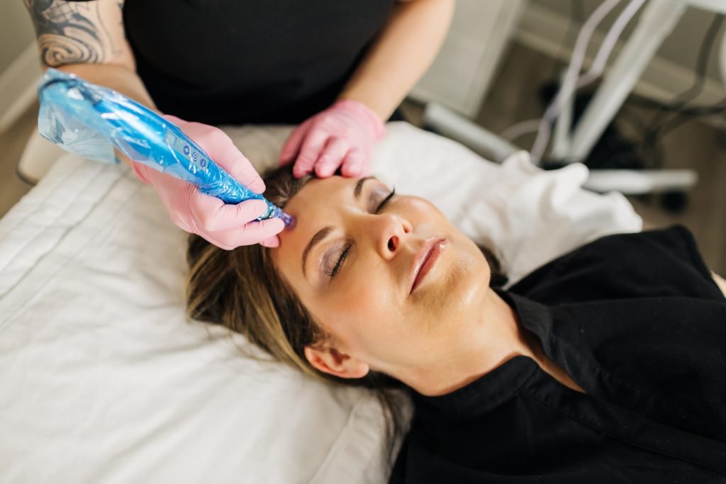 microneedling burnsville