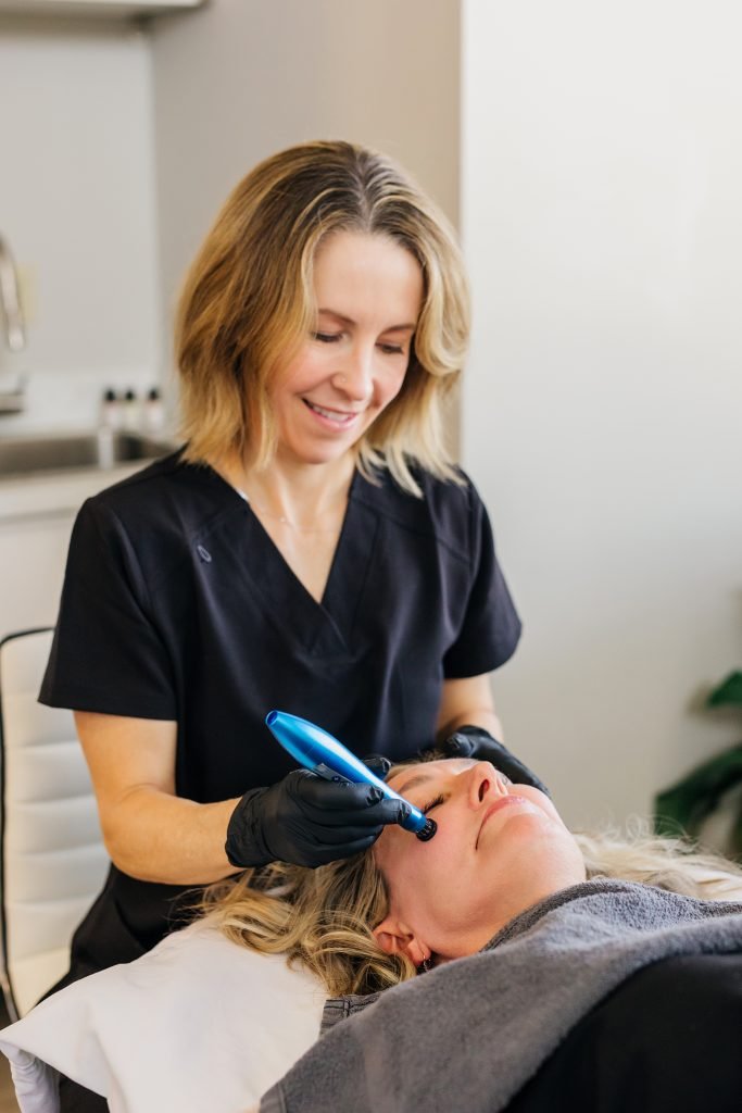 microneedling in burnsville, mn