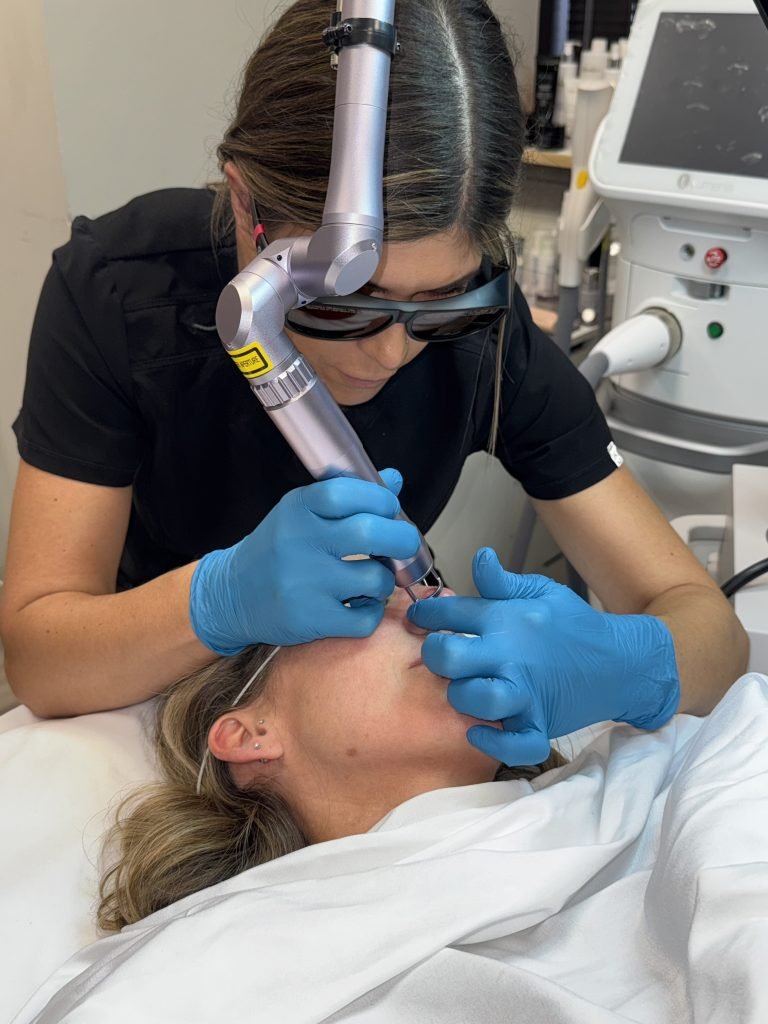 PicoLazer facial in apple valley mn