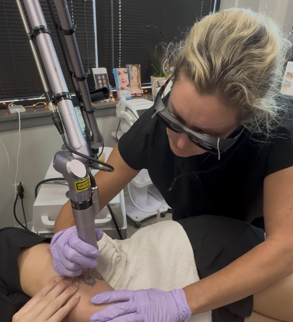 tattoo removal in apple valley mn