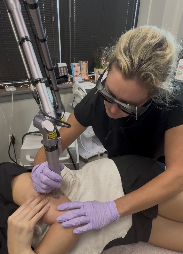 laser tattoo removal burnsville