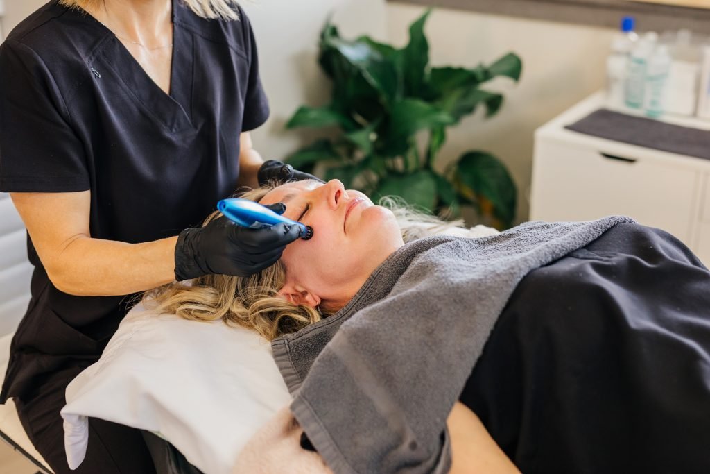 microneedling bloomington mn