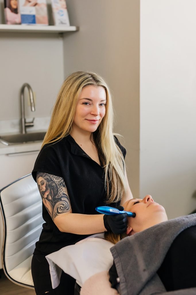 microneedling eagan mn