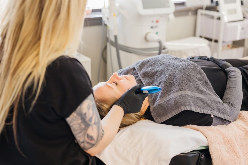 microneedling savage mn