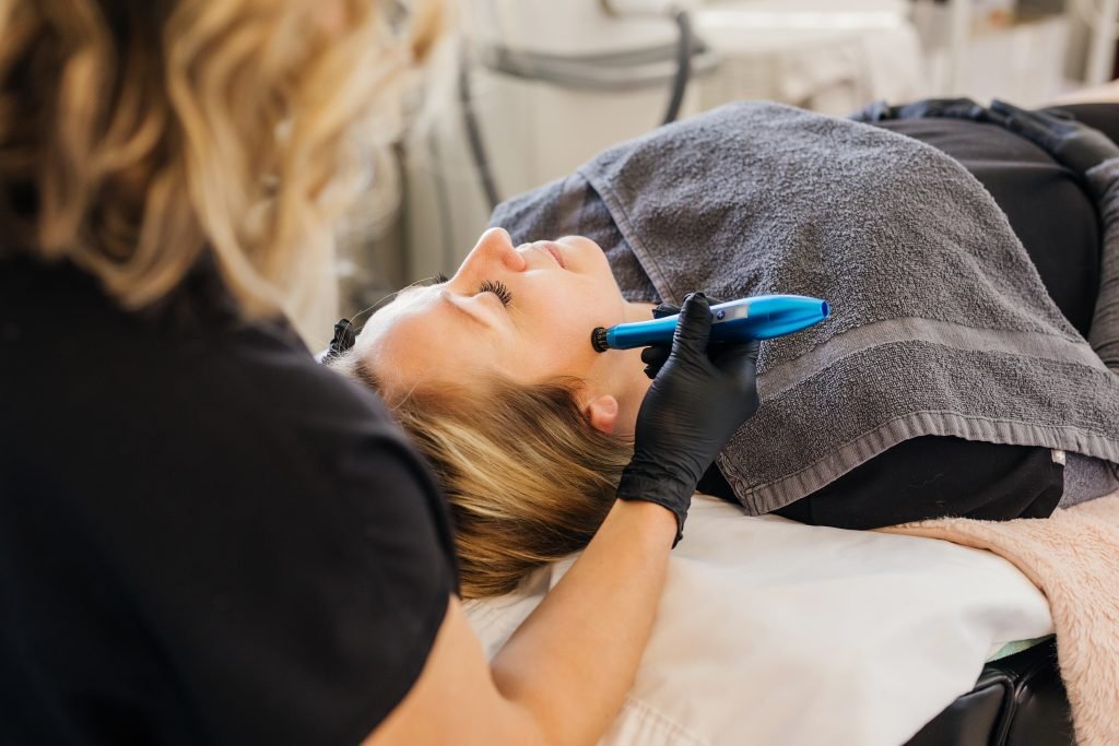 Microneedling lakeville mn