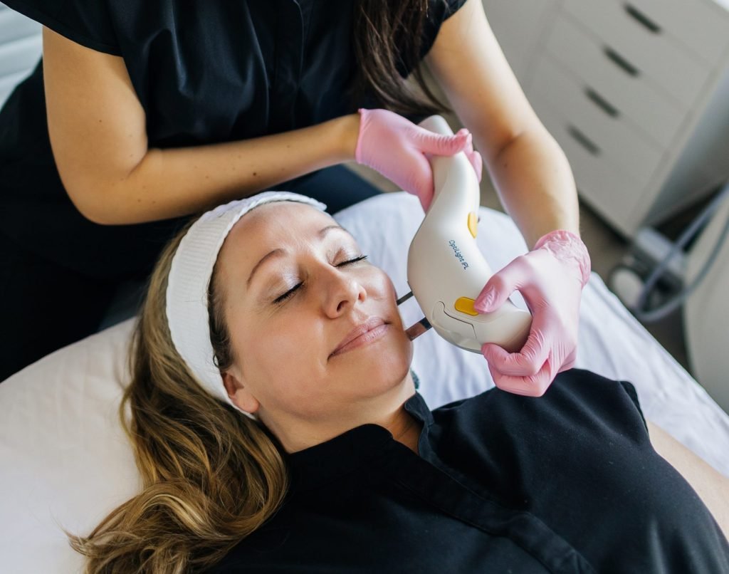 ipl photofacial savage mn