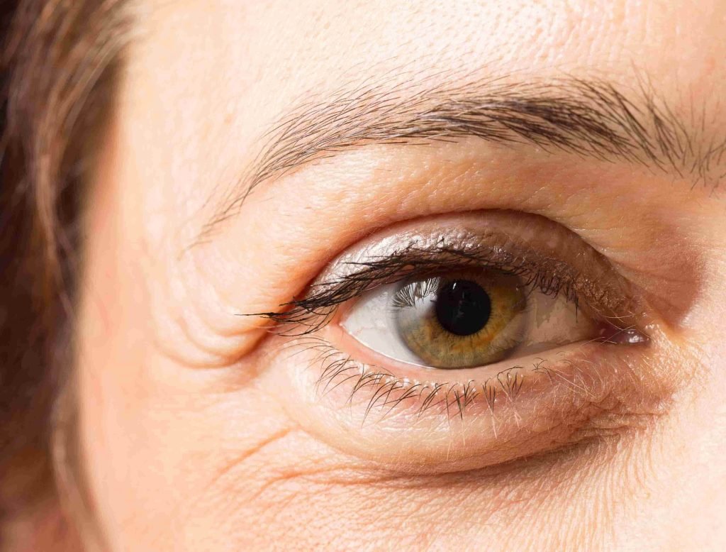 botox treatment in burnsville