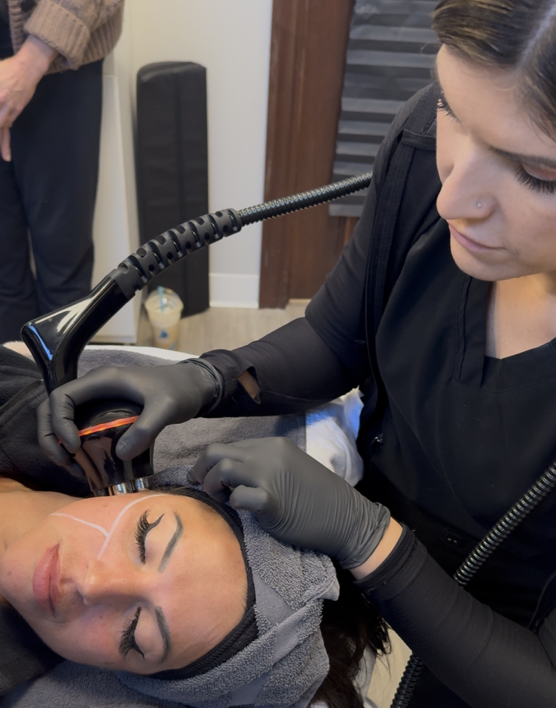 Trilift rejuvenation treatment in Burnsville